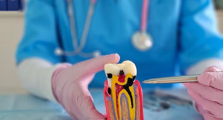 root canal in Century city